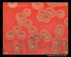 streptococcus equi